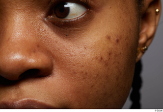 HD Face skin Calneshia Mason cheek eye pores skin texture…